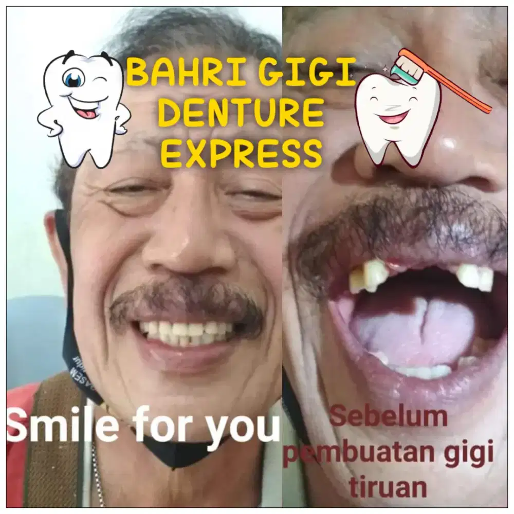 Pasang gigi palsu murah rapi