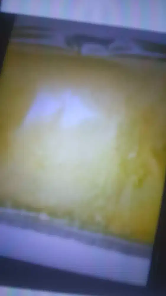 Bubuk serbuk belerang sulfur obat pnykit kulit gatal panu kadas kurap