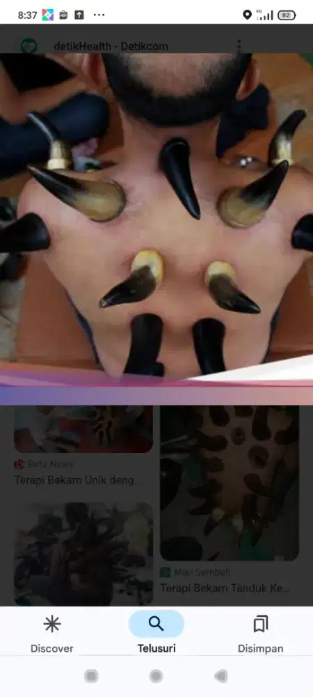 Terapi Bekam panggilan