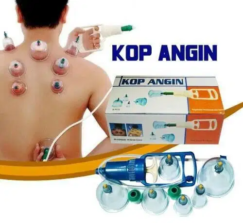 Kop angin atau alat bekam 6 tabung