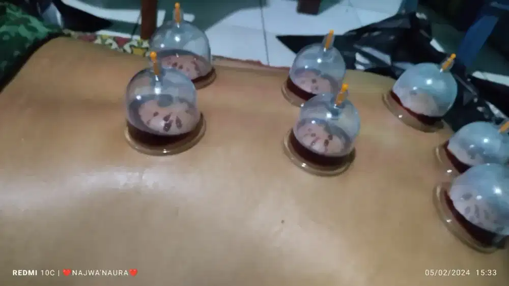 Terapi sunah BEKAM panggilan