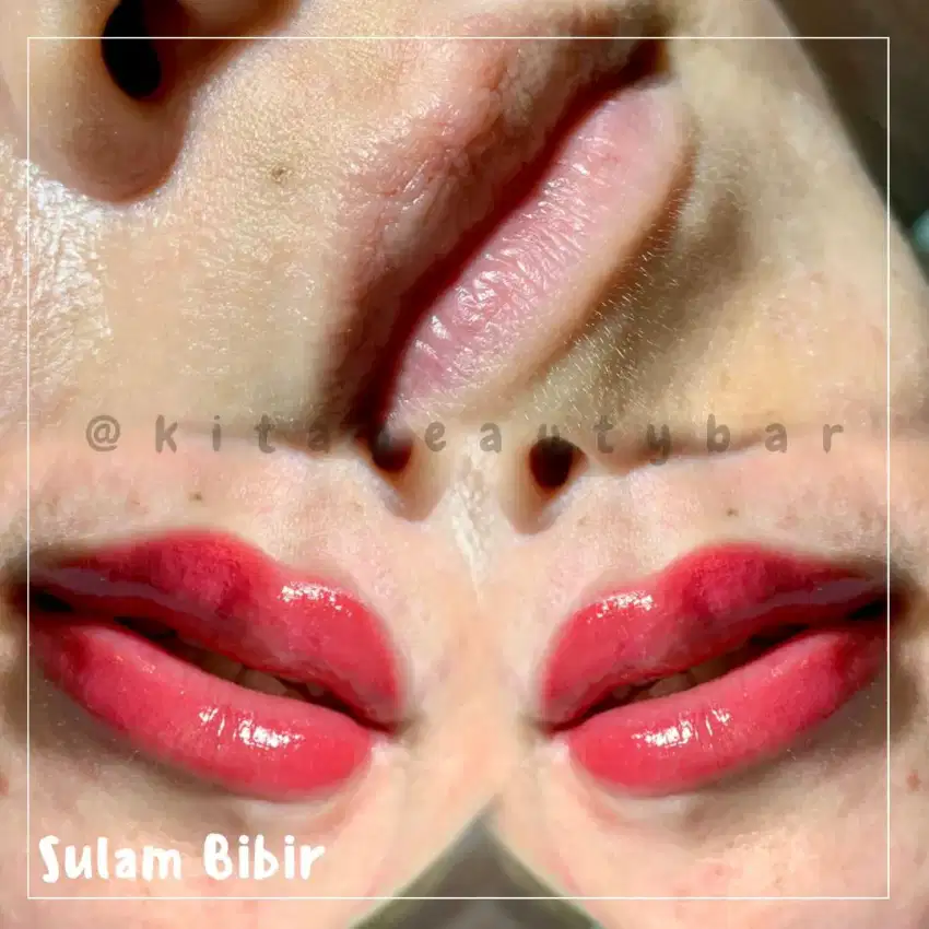 Sulam Bibir Cantik