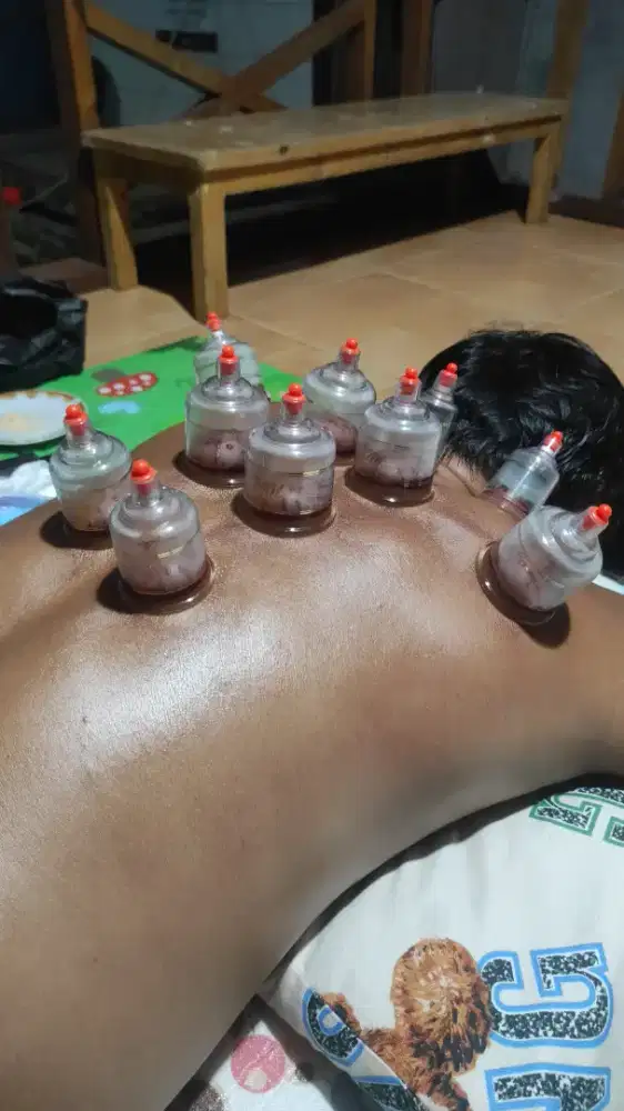 Bekam basah pangilan