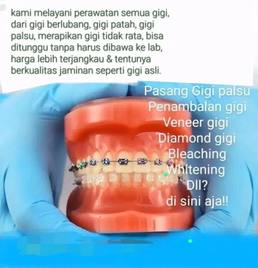 Pasang gigi palsu