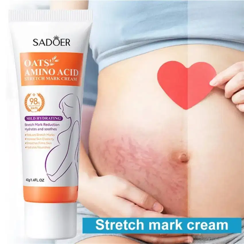 CREAM PENGHILANG STRECH MARK