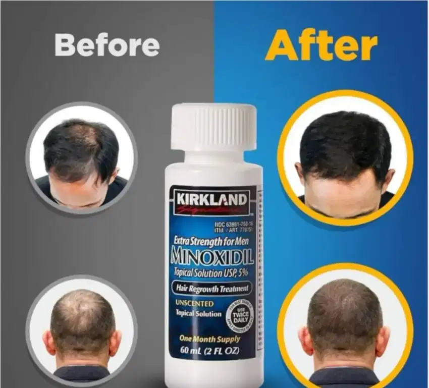 KIRKLAND MINOXIDIL BIOTIN PENUMBUH RAMBUT,BREWOK,ALIS,KUMIS,JAMBANG