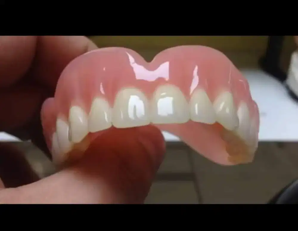 Tukang gigi terdekat (ahli pasang gigi)