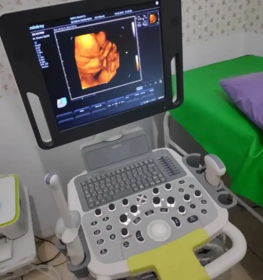 USG 4D mindray seken softcopy video via wifi