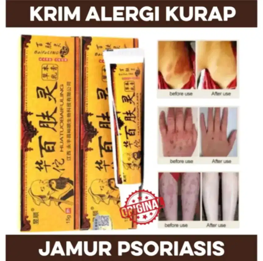 3 pcs Salep Jamur Kurap Alergi Kulit Psoriasis Eksim Ori Baifuling