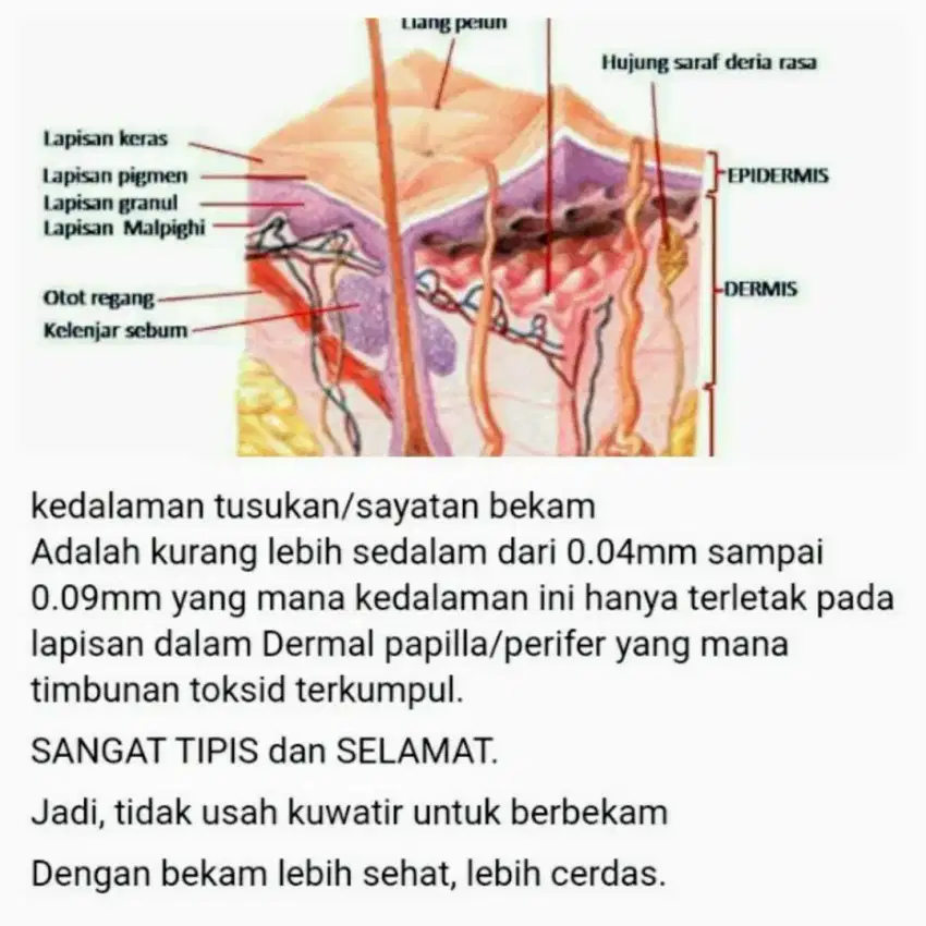 Terapi bekam panggilan ke rumah pria wanita