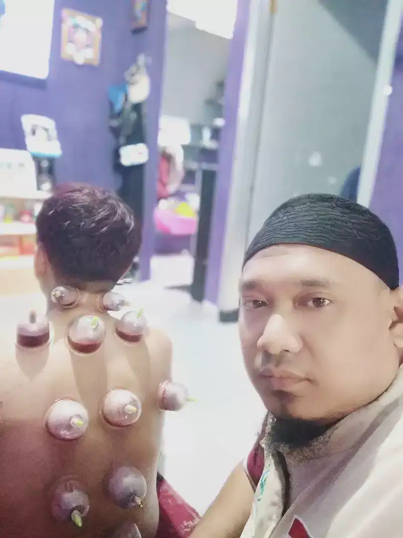 Terapi Bekam Panggilan