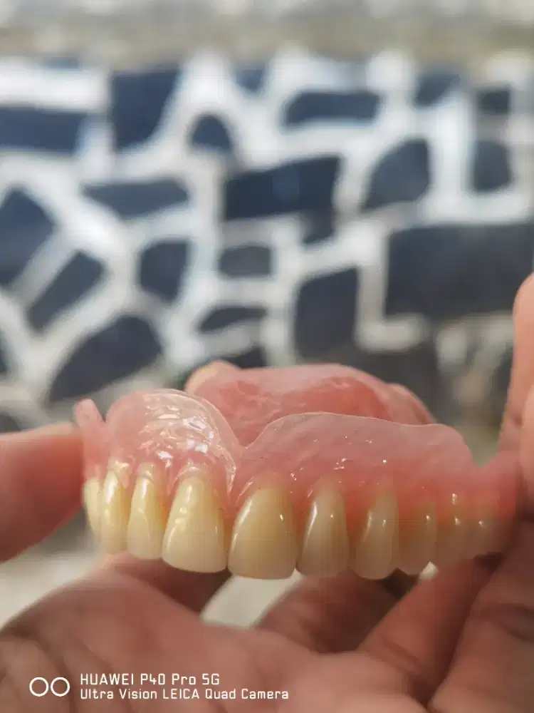 Pasang GIGI tiruan diskon 50%