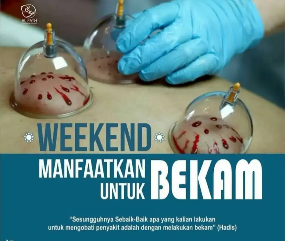 Terapi Bekam kota Palembang