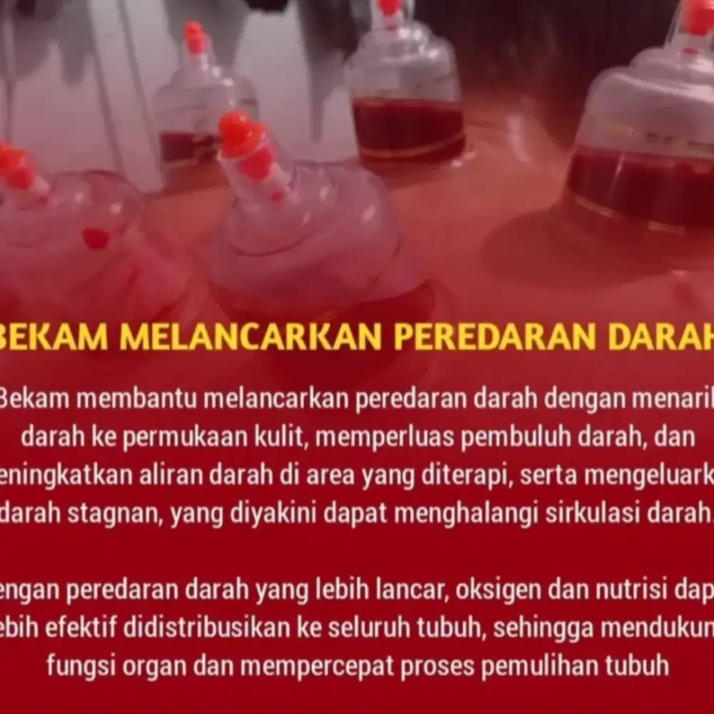 Terapi Bekam kota Palembang