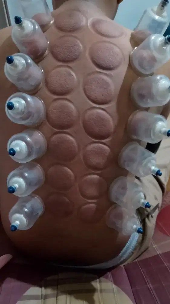 JASA BEKAM PEGAL MASUK ANGIN