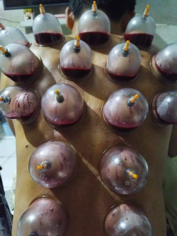 Fashdu dan Bekam panggilan bintaro