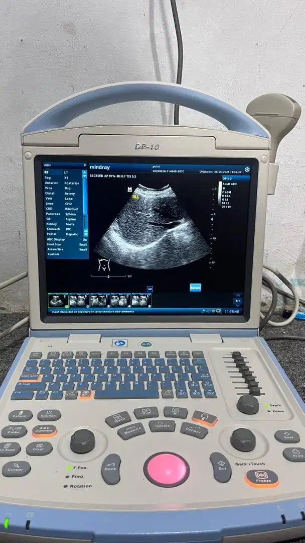 Usg 2D mindray dp 10
