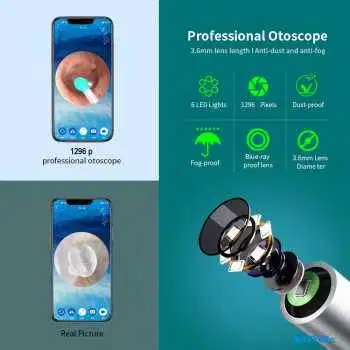 Kamera Endoskopi Pembersih Telinga Endoscope HD WiFi