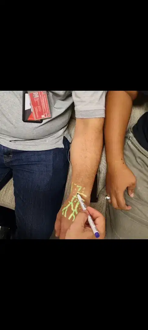 Vein finder vena