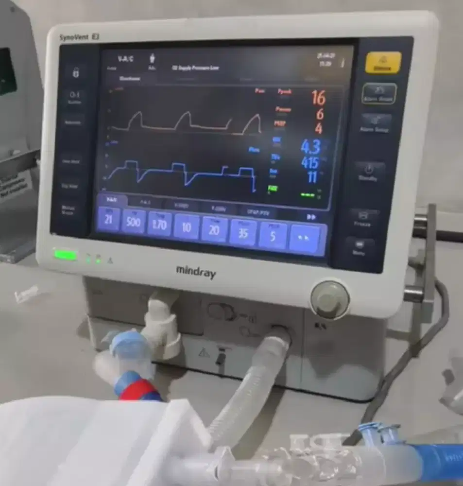 Ventilator mindray