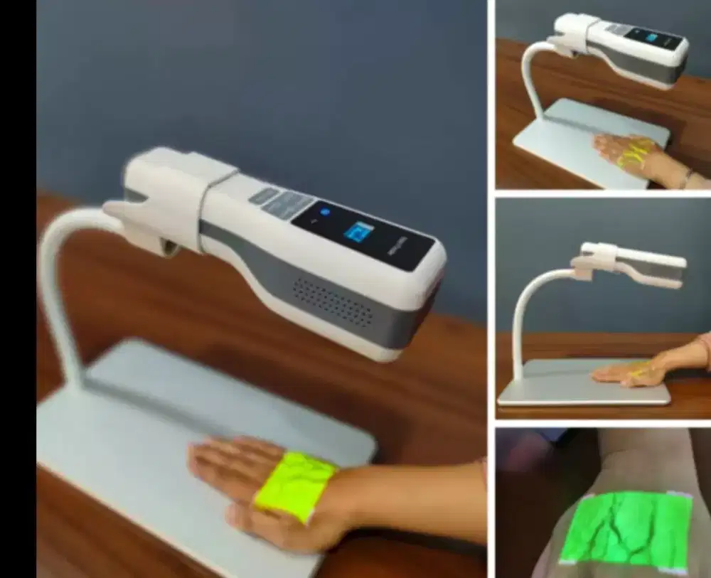 VEIN FINDER(medical equipment)