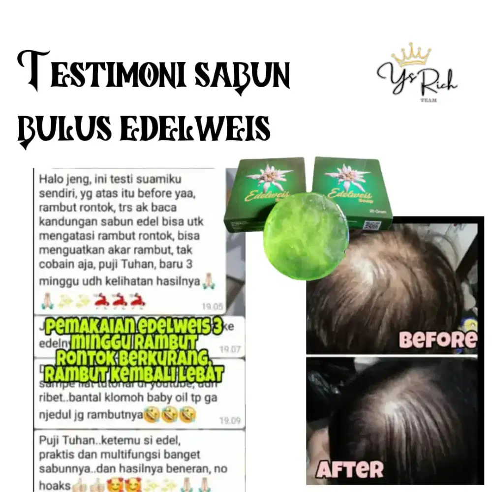 Sabun edelweis original