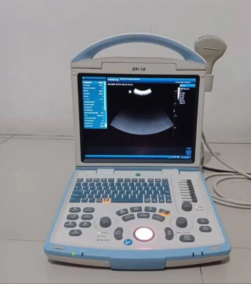 Dijual alat usg + free printer