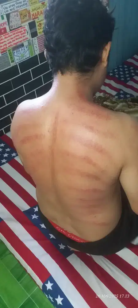 DICARI TALENT / MODEL UNTUK KONTEN PIJAT