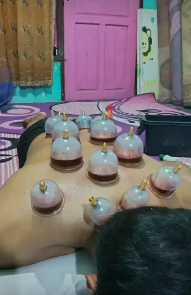 Bekam treatment terapi panggilan