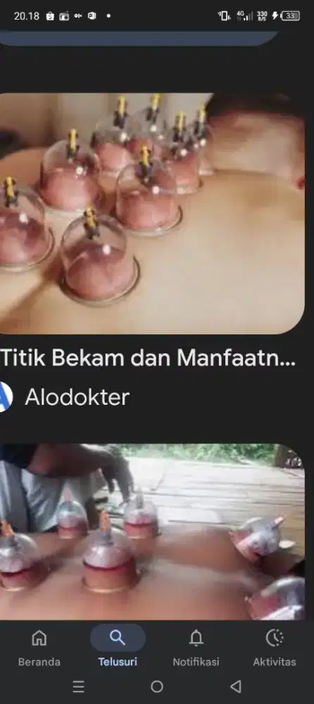 Bekam dapat menyembuhkan segala macam penyakit