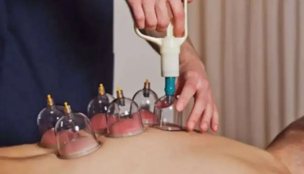 Bekam hijamah siap dipanggil ke rumah