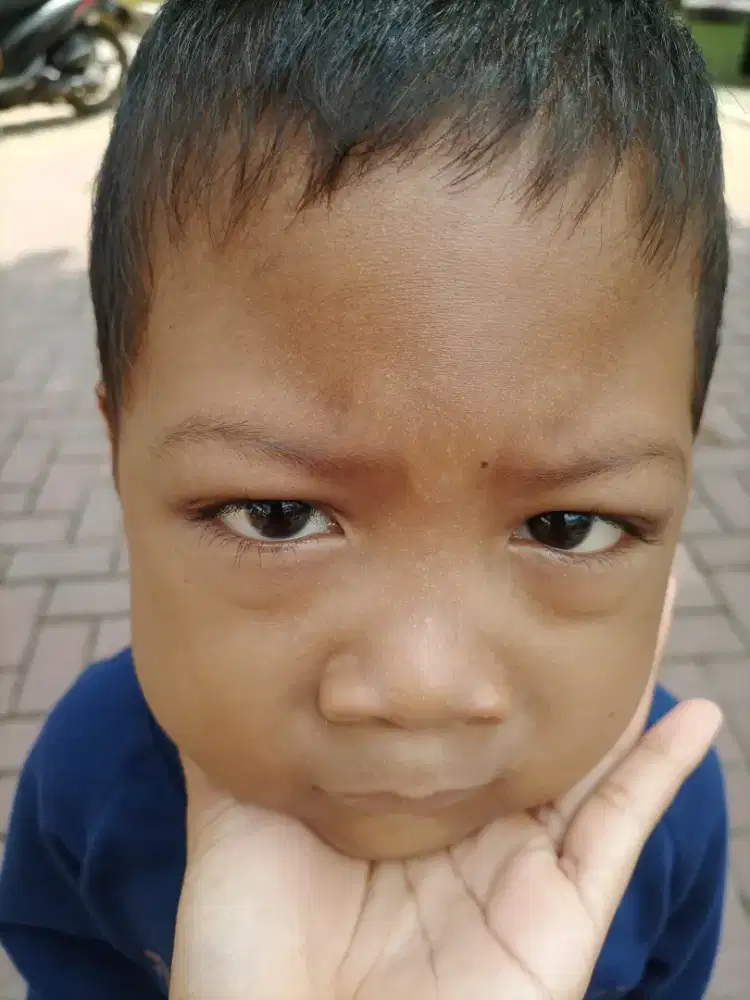 Tolong anak saya buat berobat buu