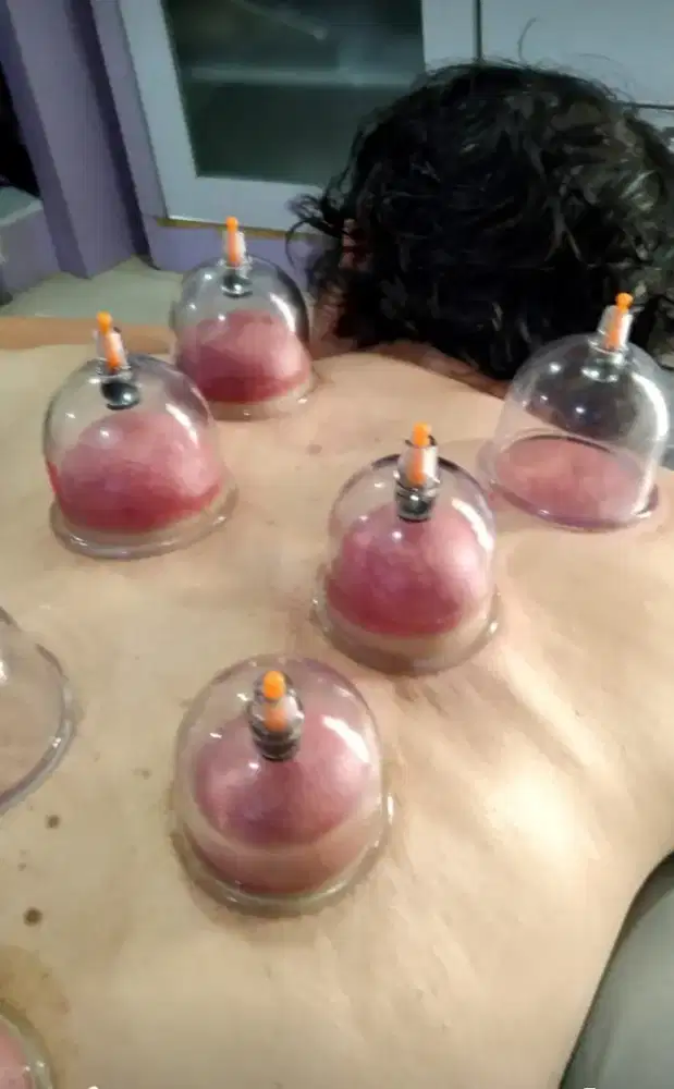 Pijat dan terapi Bekam pria