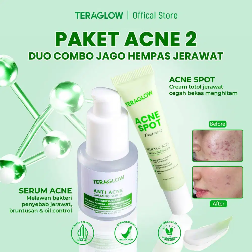 TERAGLOW PAKET ACNE 2 Serum Anti Acne & ACNE SPOT
