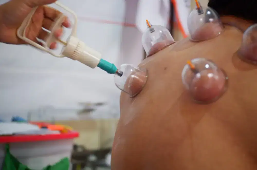 Menerima jasa panggilan totok syaraf stroke