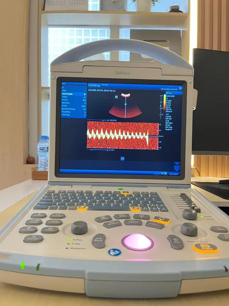 Usg mindray dp 10 doppler