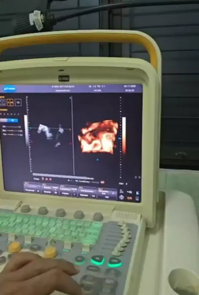 USG 4D ECOSON E66 th.2015