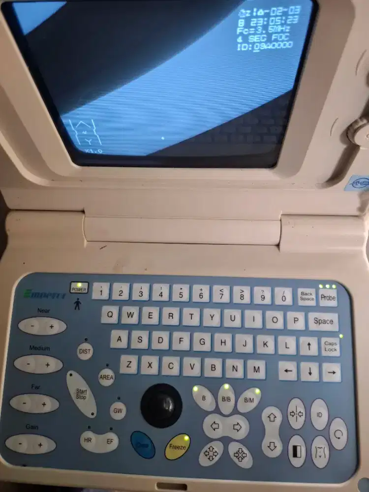 perangkat ultrasonografi (USG) portabel Mindray EMP-800. 