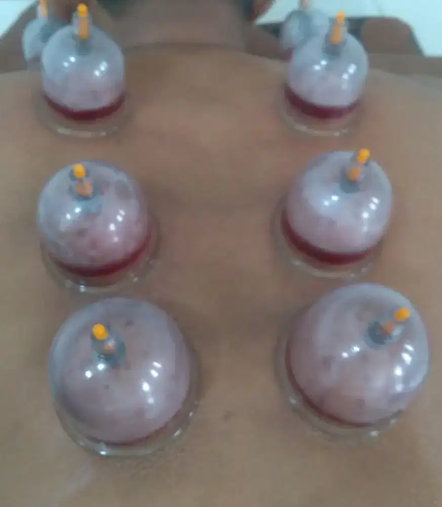 Bekam panggilan viral