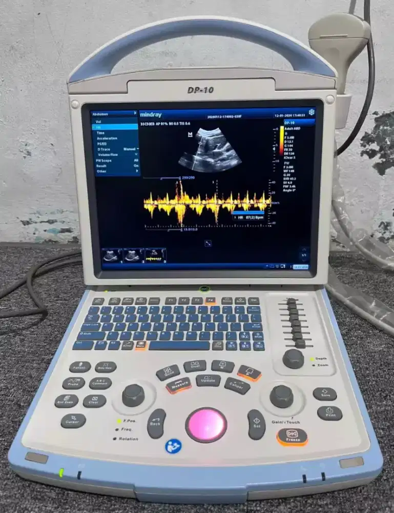 USG 2D mindray DP 10