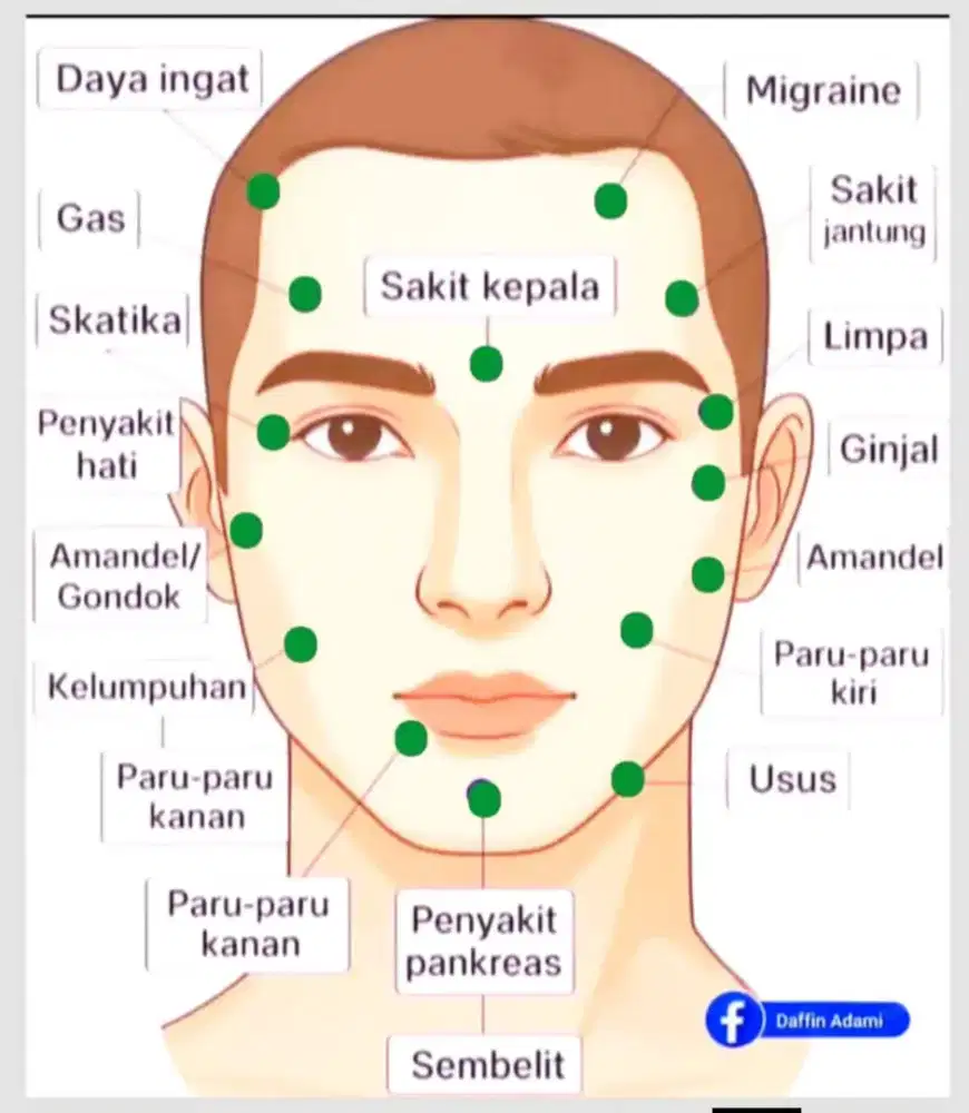Terapi Bekam Holistik