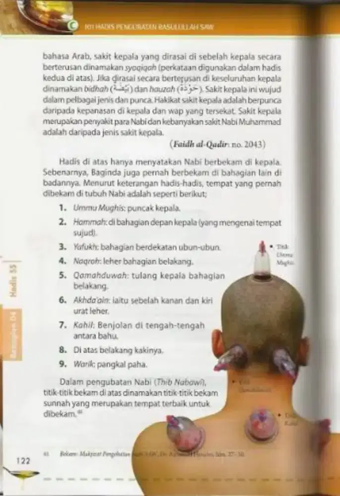 Terapis bekam topung pijat