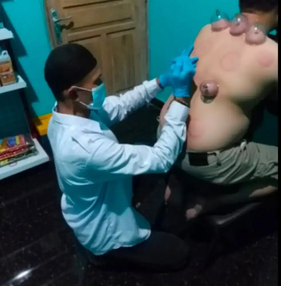 Layanan terapi Bekam