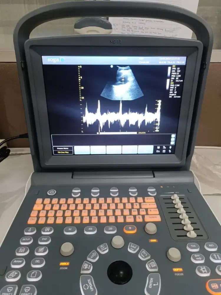 USG 2D SG 10P B/W Doppler hand carry