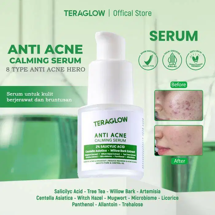 SPECIAL LIVE Teraglow Serum Anti Acne Calming 2% Salicylic Acid