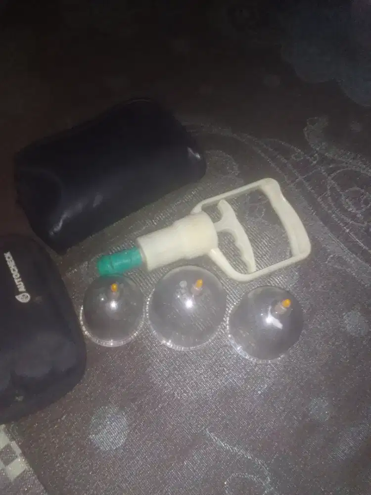 terapi kesehatan bekam