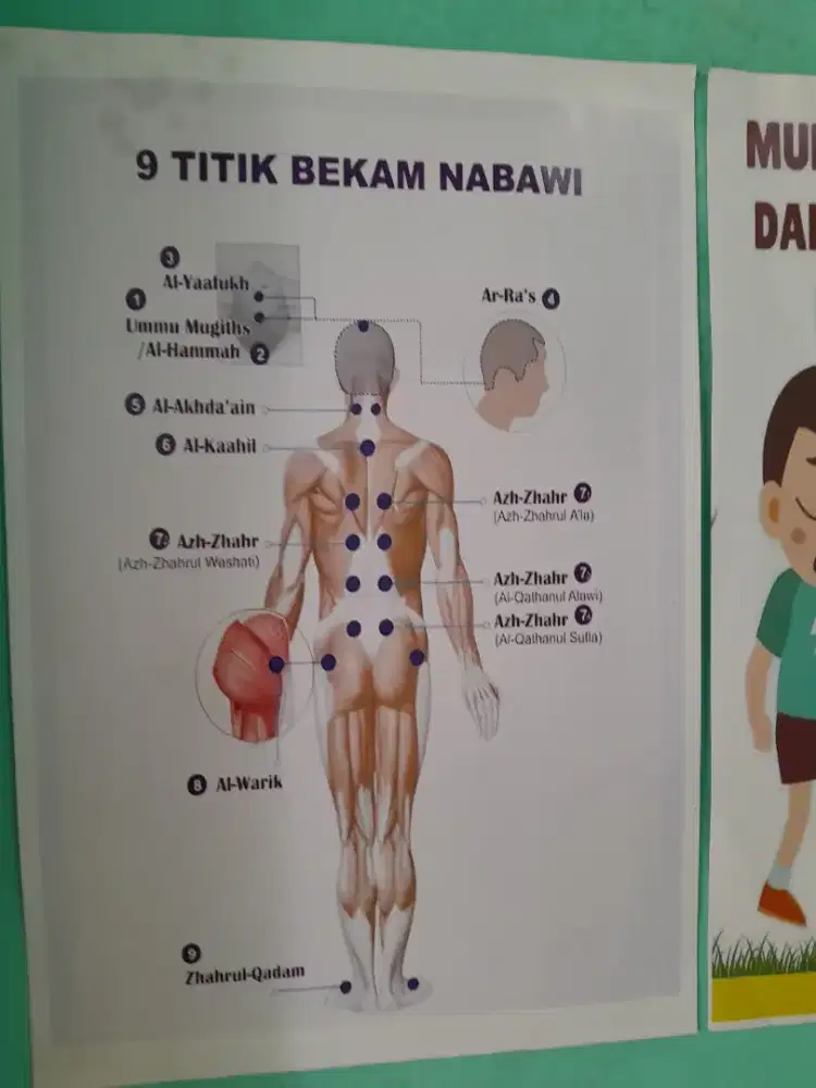 Melayani panggilan terapi bekam dan totok punggung.