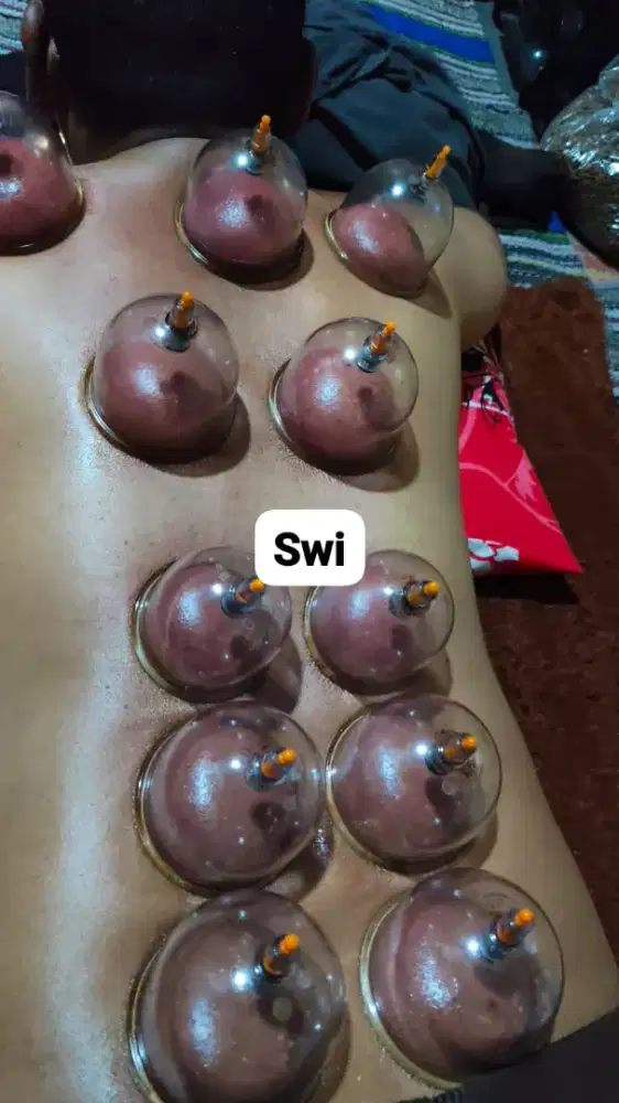 Jasa panggilan bekam singo wande indonesia