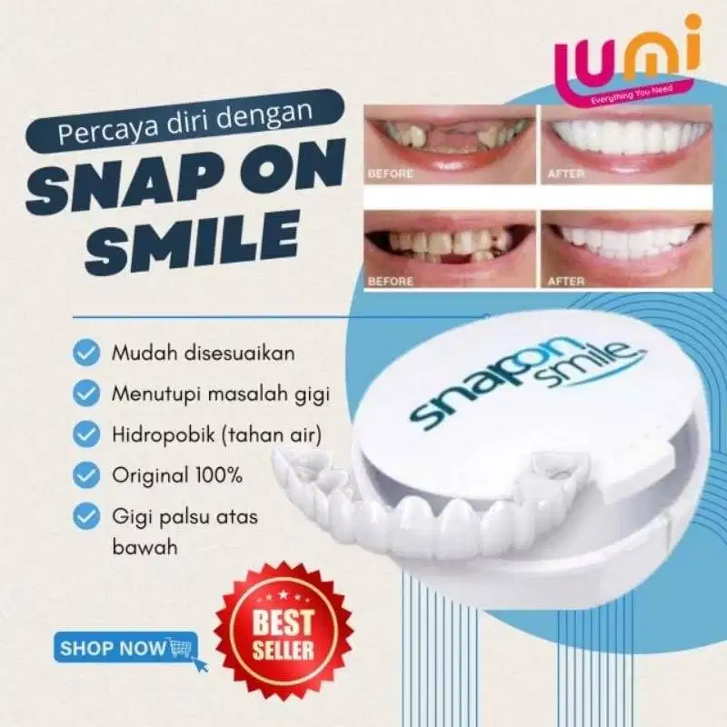 Snap On Smile Gigi Palsu Snap On Instan Free Box Atas Bawah Original 1