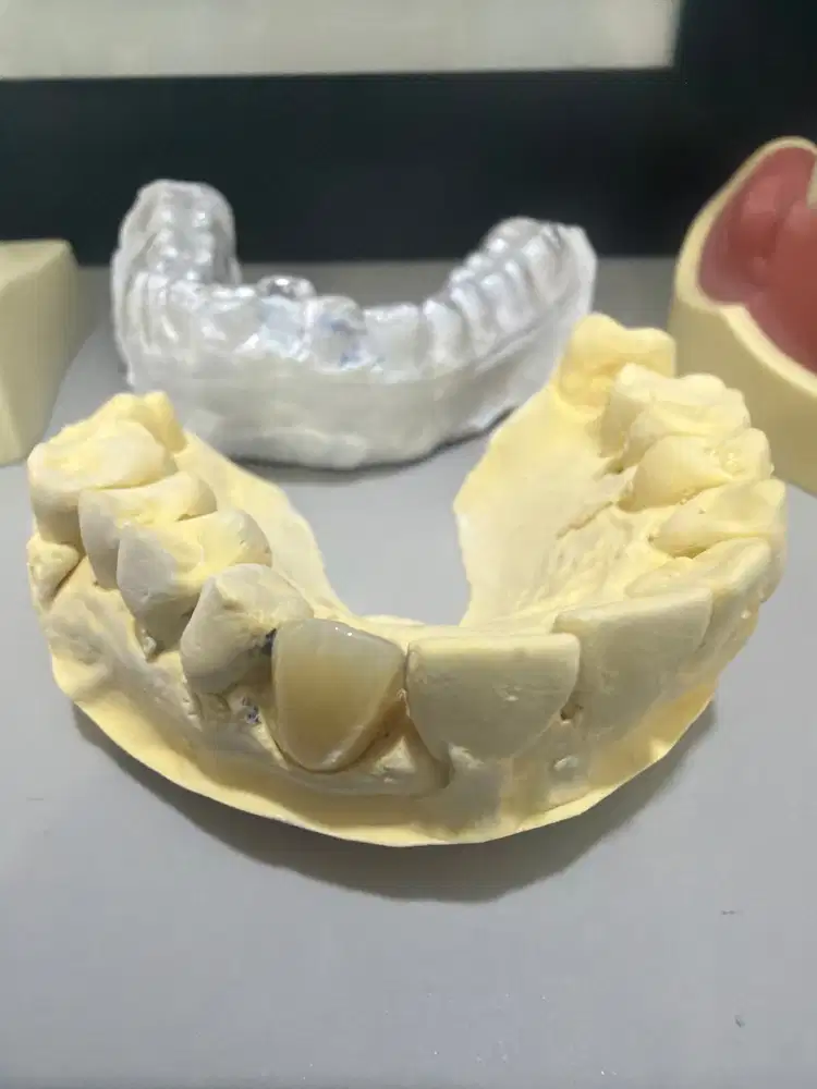 Dibutuhkan tekniker gigi dan admin